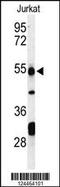 Prune Exopolyphosphatase 1 antibody, 64-092, ProSci, Western Blot image 