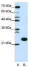 RL13 antibody, TA345690, Origene, Western Blot image 
