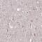 TBC1 Domain Family Member 25 antibody, PA5-56082, Invitrogen Antibodies, Immunohistochemistry paraffin image 