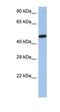 Interferon Regulatory Factor 5 antibody, orb329634, Biorbyt, Western Blot image 