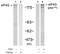 Eukaryotic Translation Initiation Factor 4 Gamma 1 antibody, LS-B11215, Lifespan Biosciences, Western Blot image 