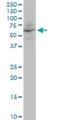 Angiopoietin Like 4 antibody, H00051129-B01P, Novus Biologicals, Western Blot image 