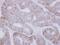 Valyl-TRNA Synthetase antibody, NBP2-20843, Novus Biologicals, Immunohistochemistry paraffin image 