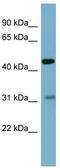 Prefoldin Subunit 5 antibody, TA342231, Origene, Western Blot image 
