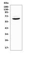Heparanase antibody, A01313, Boster Biological Technology, Western Blot image 