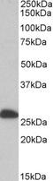 Electron Transfer Flavoprotein Subunit Beta antibody, PA5-19336, Invitrogen Antibodies, Western Blot image 