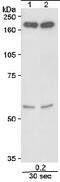 Structural Maintenance Of Chromosomes 4 antibody, ab17958, Abcam, Western Blot image 