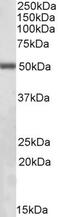 Integrin Linked Kinase antibody, EB05120, Everest Biotech, Western Blot image 