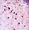 Neurotrophic Receptor Tyrosine Kinase 3 antibody, LS-C164510, Lifespan Biosciences, Immunohistochemistry frozen image 
