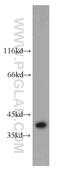 CCR4-NOT Transcription Complex Subunit 9 antibody, 22503-1-AP, Proteintech Group, Western Blot image 