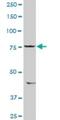 Salt Inducible Kinase 1 antibody, H00150094-D01P, Novus Biologicals, Western Blot image 