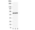 Kallikrein Related Peptidase 2 antibody, R30708, NSJ Bioreagents, Western Blot image 