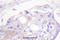 G Protein-Coupled Receptor Kinase 2 antibody, A32388T23, Boster Biological Technology, Immunohistochemistry paraffin image 