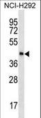 Sperm Equatorial Segment Protein 1 antibody, LS-C157074, Lifespan Biosciences, Western Blot image 