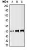 ST3 Beta-Galactoside Alpha-2,3-Sialyltransferase 3 antibody, orb215519, Biorbyt, Western Blot image 