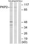 Plakophilin 2 antibody, GTX87244, GeneTex, Western Blot image 