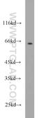 Cyclin Dependent Kinase 16 antibody, 10102-1-AP, Proteintech Group, Western Blot image 