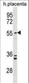 Terminal Nucleotidyltransferase 4B antibody, LS-C158527, Lifespan Biosciences, Western Blot image 