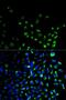 Ubiquitin C-Terminal Hydrolase L1 antibody, LS-C746713, Lifespan Biosciences, Immunofluorescence image 