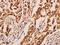 Neuralized-like protein 1A antibody, A11177, Boster Biological Technology, Immunohistochemistry paraffin image 