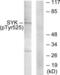 Spleen Associated Tyrosine Kinase antibody, LS-C199624, Lifespan Biosciences, Western Blot image 