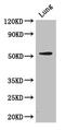 CORO1A antibody, CSB-PA005813LA01HU, Cusabio, Western Blot image 