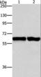 Asparagine Synthetase (Glutamine-Hydrolyzing) antibody, LS-C401414, Lifespan Biosciences, Western Blot image 