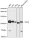 Helicase, POLQ Like antibody, 14-570, ProSci, Western Blot image 