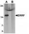 Steroid Receptor Associated And Regulated Protein antibody, TA320116, Origene, Western Blot image 