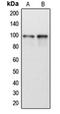DEAD-Box Helicase 54 antibody, orb215281, Biorbyt, Western Blot image 