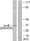 JunB Proto-Oncogene, AP-1 Transcription Factor Subunit antibody, LS-C117401, Lifespan Biosciences, Western Blot image 