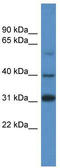 SRY-Box 1 antibody, TA335704, Origene, Western Blot image 