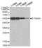 Tubulin Beta 3 Class III antibody, abx005574, Abbexa, Western Blot image 