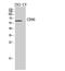 CD96 Molecule antibody, A05179, Boster Biological Technology, Western Blot image 