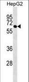 Polypyrimidine Tract Binding Protein 3 antibody, LS-C158882, Lifespan Biosciences, Western Blot image 