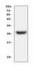 Complement Factor D antibody, A01134-1, Boster Biological Technology, Western Blot image 