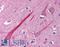 TNF Receptor Superfamily Member 14 antibody, LS-B1424, Lifespan Biosciences, Immunohistochemistry frozen image 