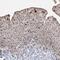 NSE4 Homolog A, SMC5-SMC6 Complex Component antibody, HPA037459, Atlas Antibodies, Immunohistochemistry paraffin image 