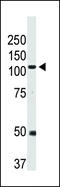 Bone Morphogenetic Protein Receptor Type 2 antibody, 60-854, ProSci, Western Blot image 