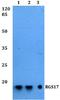 Regulator Of G Protein Signaling 17 antibody, A08813, Boster Biological Technology, Western Blot image 