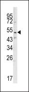 SET And MYND Domain Containing 3 antibody, PA5-14230, Invitrogen Antibodies, Western Blot image 