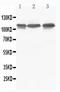 ICAM1 antibody, PA1110, Boster Biological Technology, Western Blot image 