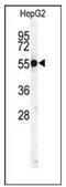 CPSB antibody, AP17259PU-N, Origene, Western Blot image 