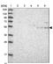 UDP-Glucose Ceramide Glucosyltransferase antibody, NBP1-83376, Novus Biologicals, Western Blot image 