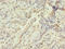 Histone Cluster 1 H2A Family Member M antibody, LS-C285528, Lifespan Biosciences, Immunohistochemistry paraffin image 