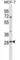 SRP Receptor Subunit Beta antibody, abx028597, Abbexa, Western Blot image 