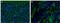 Complement C3b/C4b Receptor 1 (Knops Blood Group) antibody, MA5-17711, Invitrogen Antibodies, Immunofluorescence image 