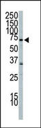 Phosphoinositide-3-Kinase Regulatory Subunit 2 antibody, 63-350, ProSci, Western Blot image 