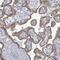 Collagen Type XIII Alpha 1 Chain antibody, NBP2-13854, Novus Biologicals, Immunohistochemistry frozen image 