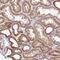 Translocase Of Inner Mitochondrial Membrane 10B antibody, NBP2-14031, Novus Biologicals, Immunohistochemistry paraffin image 